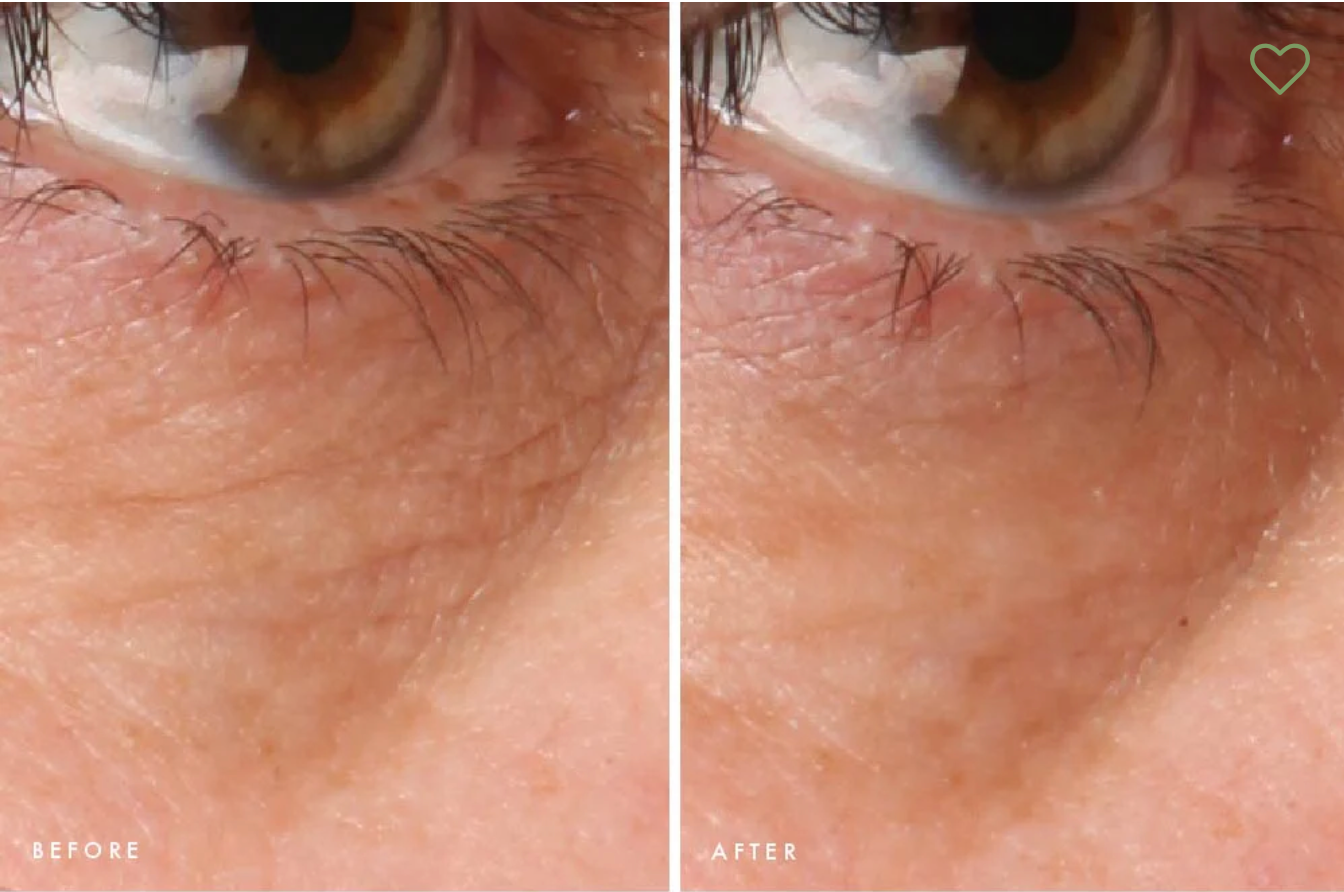 Crow Catcher Eye Transforming Serum